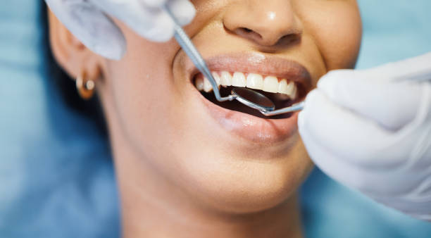 Best Mobile Emergency Dentist in Columbus Grove, OH