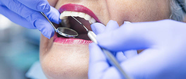 Best Emergency Dentist for Knocked-Out Tooth in Columbus Grove, OH